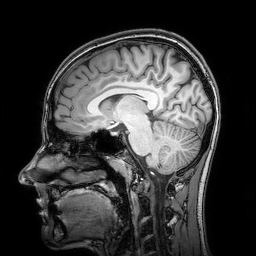 Vergrösserte Ansicht: MRI Kopf